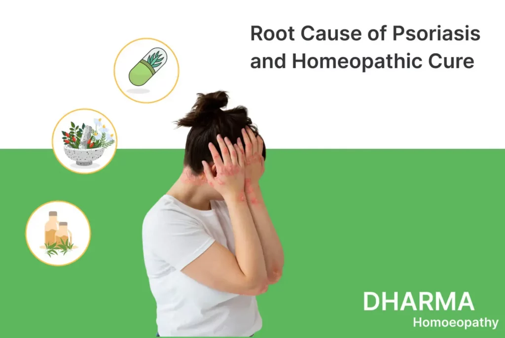 Root Cause of Psoriasis and Homeopathic Cure